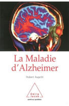 La maladie d'alzheimer